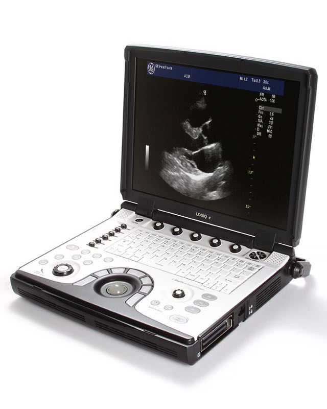 GE Logiq e Portable Ultrasound Machine