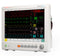 Edan iM80 Patient Monitor