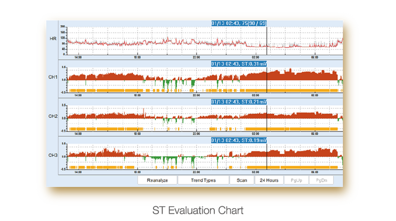 Edan SE 2003 / 2012 Holter monitor