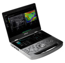 Mindray MX7 Ultrasound Cardiac Package 2 Probes