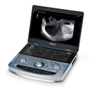 Mindray MX7 Ultrasound Cardiac Package 2 Probes