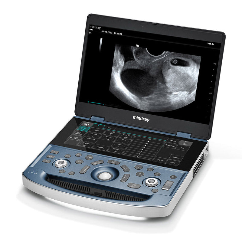 Mindray MX7 Ultrasound Brand New