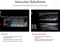 Mindray MX7 Ultrasound MSK Package 1 Probe