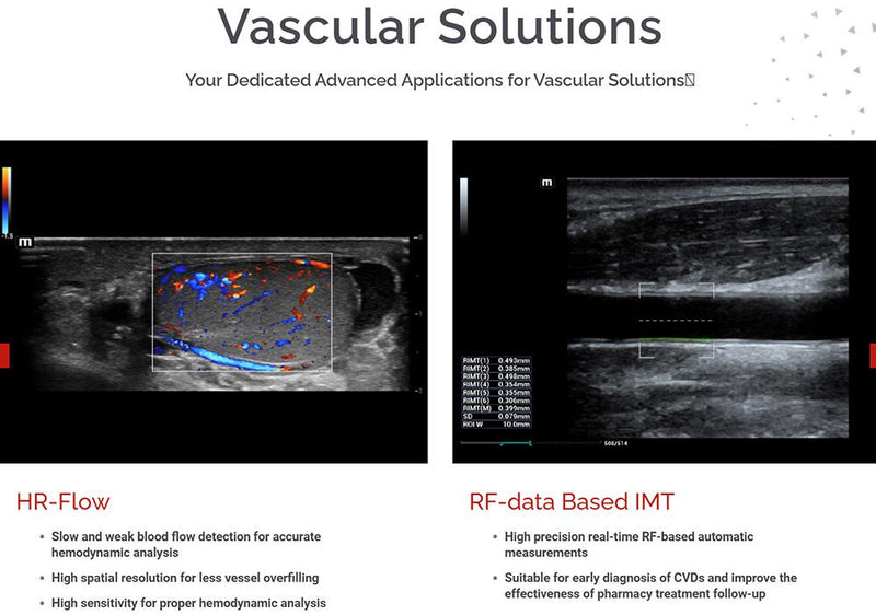 Mindray MX7 Ultrasound Cardiac Package 2 Probes