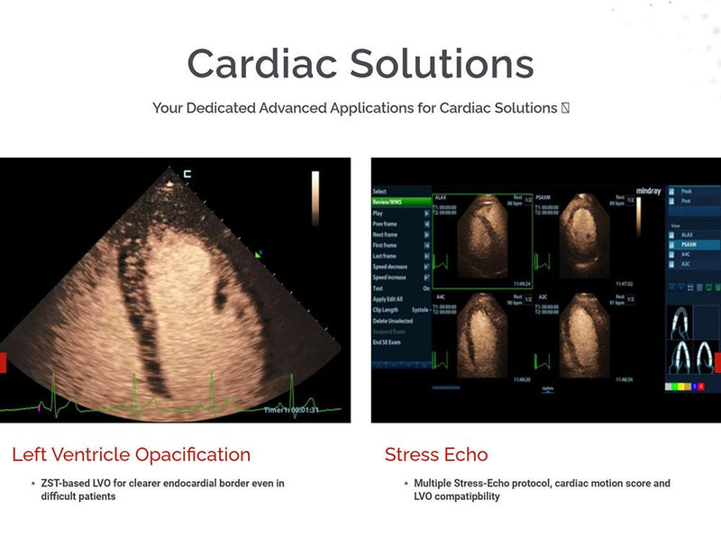 Mindray MX7 Ultrasound Cardiac Package 2 Probes