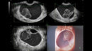 GE VOLUSON E8 Refurbished WITH 3 Probes