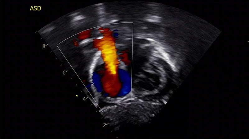 GE VIVID IQ Refurbished with 2 Probes