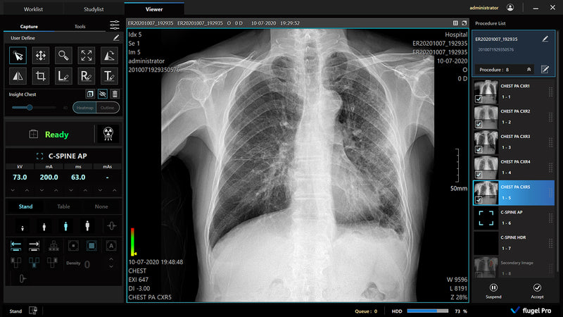 Digital X-Ray XR-5 Premium